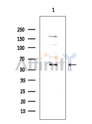 ZNF440 Antibody - Western blot analysis of extracts from COLO205 cells(heat-shock treatment), using ZNF440 Antibody at 1/1000 dilution.