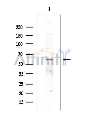 ZNF440 Antibody - Western blot analysis of extracts from EC304 cells(heat-shock treatment), using ZNF440 Antibody at 1/1000 dilution.