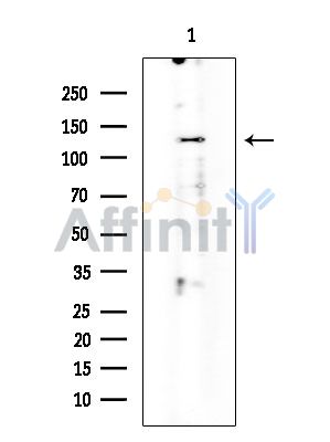 ITGAM Antibody - Western blot analysis of extracts from Mouse testis, using ITGAM Antibody at 1/1000 dilution.