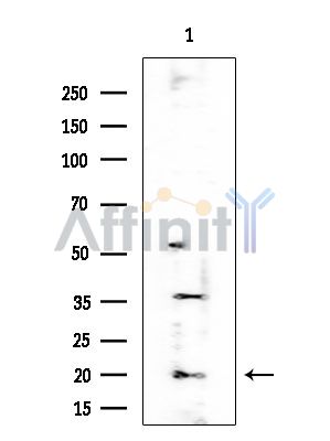 CIRBP Antibody - Western blot analysis of extracts from Mouse testis, using CIRBP Antibody at 1/1000 dilution.