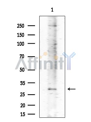 ABHD11 Antibody - Western blot analysis of extracts from Mouse testis, using ABHD11 Antibody at 1/1000 dilution.