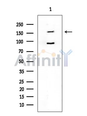 GPR158 Antibody - Western blot analysis of extracts from COLO205 cells(heat-shock treatment), using GPR158 Antibody at 1/1000 dilution.