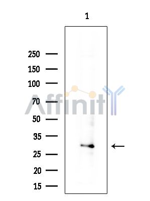 NUDT6 Antibody - Western blot analysis of extracts from COLO205 cells(heat-shock treatment), using NUDT6 Antibody at 1/1000 dilution.