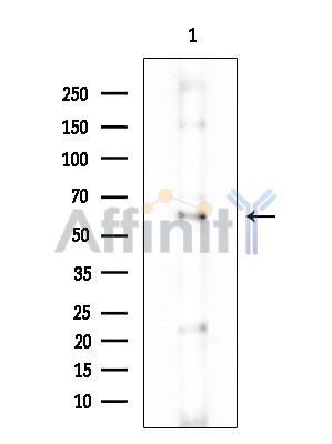 UMOD Antibody - Western blot analysis of extracts from COLO205 cells(heat-shock treatment), using UMOD Antibody at 1/1000 dilution.