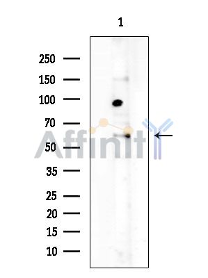 UMOD Antibody - Western blot analysis of extracts from EC304 cells(heat-shock treatment), using UMOD Antibody at 1/1000 dilution.