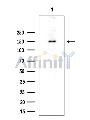 PER3 Antibody - Western blot analysis of extracts from EC304 cells(heat-shock treatment), using PER3 Antibody at 1/1000 dilution.