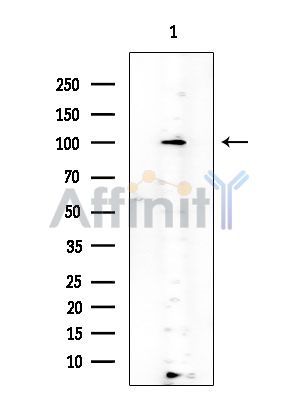 CD10 Antibody - Western blot analysis of extracts from COLO205 cells(heat-shock treatment), using CD10 Antibody at 1/1000 dilution.