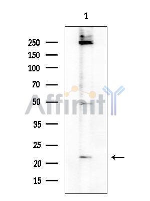 CD179b Antibody - Western blot analysis of extracts from Rat brain, using CD179b Antibody at 1/1000 dilution.