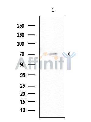 HDAC10 Antibody - Western blot analysis of extracts from EC304 cells(heat-shock treatment), using HDAC10 Antibody at 1/1000 dilution.