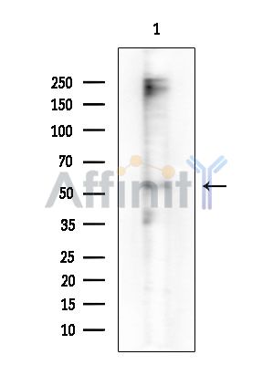 Cytokeratin 5 Antibody - Western blot analysis of extracts from Rat brain, using Cytokeratin 5 Antibody at 1/1000 dilution.