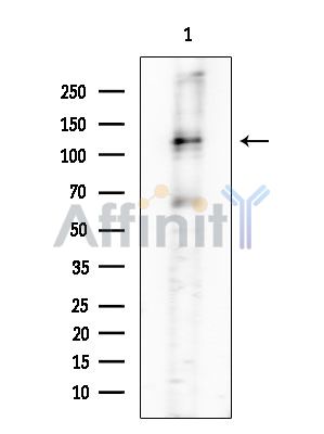 Phospho-CD45 (Ser1007)[Ser1009] Antibody - Western blot analysis of extracts from Mouse testis, using Phospho-CD45 (Ser1007)[Ser1009] Antibody at 1/1000 dilution.