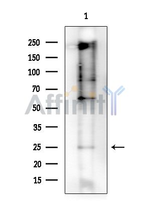 Twist1 Antibody - Western blot analysis of extracts from Rat brain, using Twist1 Antibody at 1/1000 dilution.