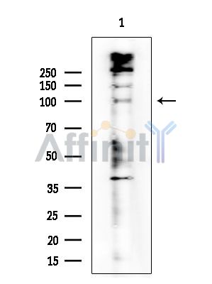 N Cadherin Antibody - Western blot analysis of extracts from Rat brain, using N Cadherin Antibody at 1/1000 dilution.