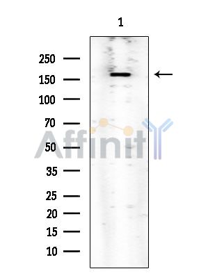 ROCK1 Mouse Monoclonal Antibody - Western blot analysis of extracts from COLO205 cells, using ROCK1 Mouse Monoclonal Antibody at 1/1000 dilution.