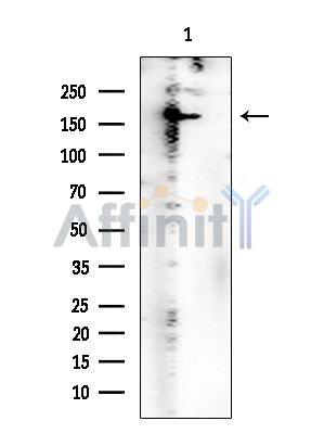 ROCK1 Mouse Monoclonal Antibody - Western blot analysis of extracts from EC304 cells, using ROCK1 Mouse Monoclonal Antibody at 1/1000 dilution.