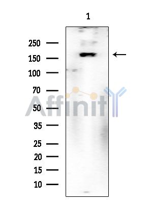 ROCK1 Mouse Monoclonal Antibody - Western blot analysis of extracts from Mouse lung, using ROCK1 Mouse Monoclonal Antibody at 1/1000 dilution.