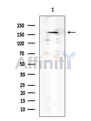 ROCK1 Mouse Monoclonal Antibody - Western blot analysis of extracts from PC12 cells, using ROCK1 Mouse Monoclonal Antibody at 1/1000 dilution.