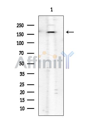 ROCK1 Mouse Monoclonal Antibody - Western blot analysis of extracts from Hela cells, using ROCK1 Mouse Monoclonal Antibody at 1/1000 dilution.