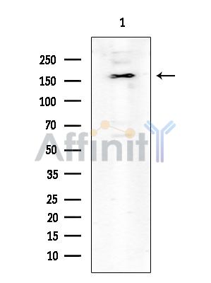 ROCK1 Mouse Monoclonal Antibody - Western blot analysis of extracts from HUVEC cells, using ROCK1 Mouse Monoclonal Antibody at 1/1000 dilution.