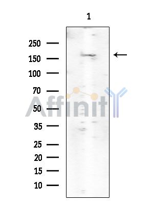 ROCK1 Mouse Monoclonal Antibody - Western blot analysis of extracts from Mouse spleen, using ROCK1 Mouse Monoclonal Antibody at 1/1000 dilution.