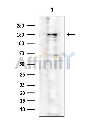 ROCK1 Mouse Monoclonal Antibody - Western blot analysis of extracts from Rat lung, using ROCK1 Mouse Monoclonal Antibody at 1/1000 dilution.