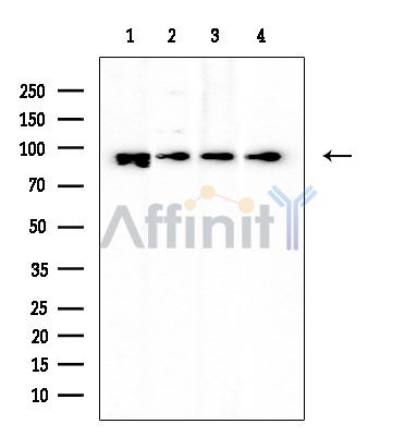 p95/NBS1 Mouse Monoclonal Antibody - Western blot analysis of extracts from various samples, using p95/NBS1 Mouse Monoclonal Antibody at 1/1000 dilution.