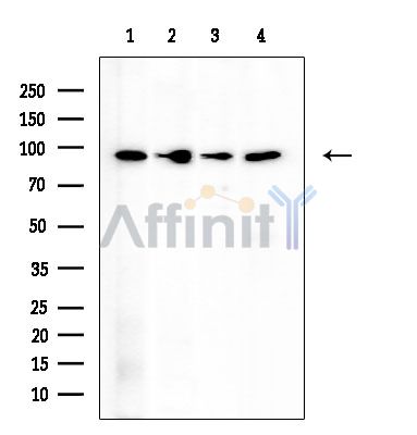 p95/NBS1 Mouse Monoclonal Antibody - Western blot analysis of extracts from various samples, using p95/NBS1 Mouse Monoclonal Antibody at 1/1000 dilution.