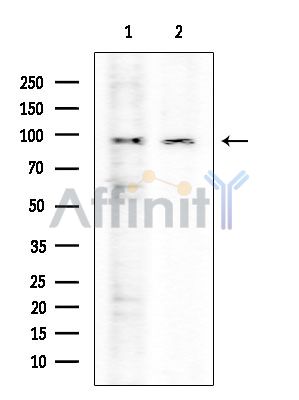 p95/NBS1 Mouse Monoclonal Antibody - Western blot analysis of extracts from various samples, using p95/NBS1 Mouse Monoclonal Antibody at 1/1000 dilution.