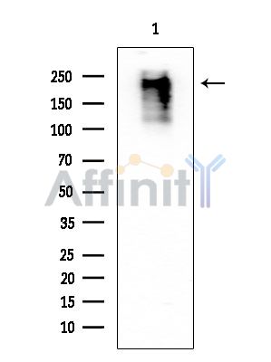 Rpb1 CTD Mouse Monoclonal Antibody - Western blot analysis of extracts from Rat spleen, using Rpb1 CTD Mouse Monoclonal Antibody at 1/1000 dilution.