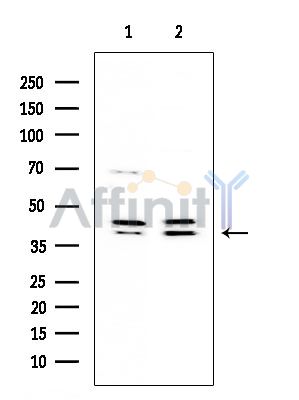 MKK3/MKK6 Mouse Monoclonal Antibody - Western blot analysis of extracts from various samples, using MKK3/MKK6 Mouse Monoclonal Antibody at 1/1000 dilution.