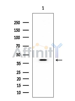 MKK3/MKK6 Mouse Monoclonal Antibody - Western blot analysis of extracts from Mouse brain, using MKK3/MKK6 Mouse Monoclonal Antibody at 1/1000 dilution.