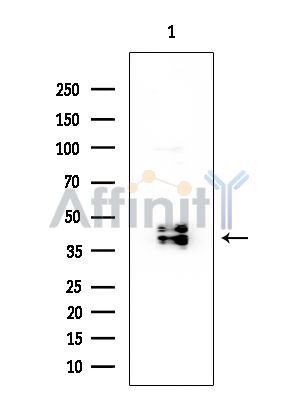 MKK3/MKK6 Mouse Monoclonal Antibody - Western blot analysis of extracts from COLO205 cells, using MKK3/MKK6 Mouse Monoclonal Antibody at 1/1000 dilution.