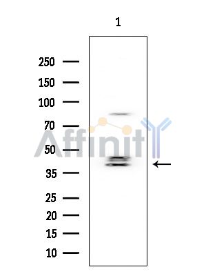 MKK3/MKK6 Mouse Monoclonal Antibody - Western blot analysis of extracts from Mouse testis, using MKK3/MKK6 Mouse Monoclonal Antibody at 1/1000 dilution.