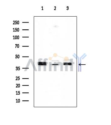 MKK3/MKK6 Mouse Monoclonal Antibody - Western blot analysis of extracts from various samples, using MKK3/MKK6 Mouse Monoclonal Antibody at 1/1000 dilution.