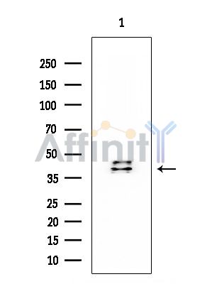 MKK3/MKK6 Mouse Monoclonal Antibody - Western blot analysis of extracts from Mouse spleen, using MKK3/MKK6 Mouse Monoclonal Antibody at 1/1000 dilution.