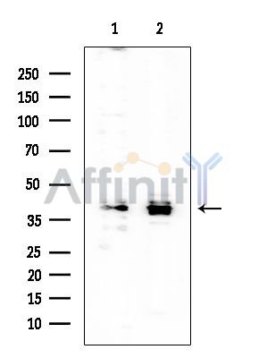 MKK3/MKK6 Mouse Monoclonal Antibody - Western blot analysis of extracts from various samples, using MKK3/MKK6 Mouse Monoclonal Antibody at 1/1000 dilution.
