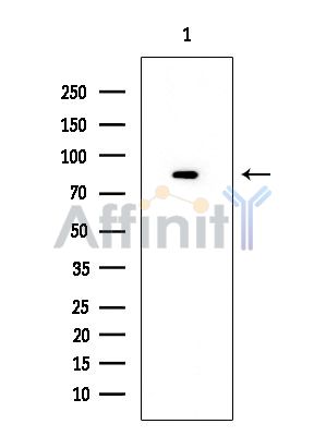 Hsp90 alpha Mouse Monoclonal Antibody - Western blot analysis of extracts from EC304 cells, using Hsp90 alpha Mouse Monoclonal Antibody at 1/1000 dilution.
