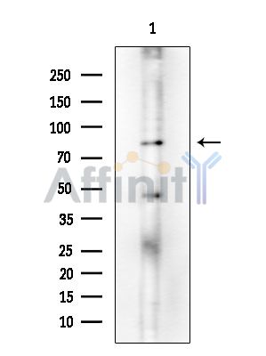 Hsp90 alpha Mouse Monoclonal Antibody - Western blot analysis of extracts from Rat testis, using Hsp90 alpha Mouse Monoclonal Antibody at 1/1000 dilution.