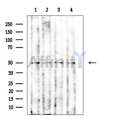 DDX39 Mouse Monoclonal Antibody - Western blot analysis of extracts from various samples, using DDX39 Mouse Monoclonal Antibody at 1/1000 dilution.