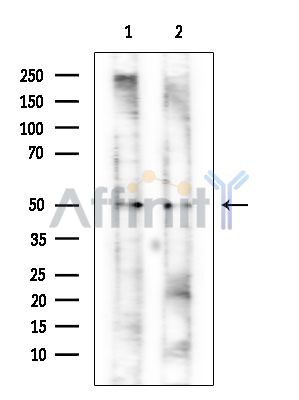 DDX39 Mouse Monoclonal Antibody - Western blot analysis of extracts from various samples, using DDX39 Mouse Monoclonal Antibody at 1/1000 dilution.