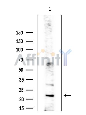 EFNA1 Antibody - Western blot analysis of extracts from COLO205 cells(heat-shock treatment), using EFNA1 Antibody at 1/1000 dilution.