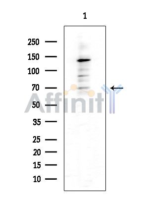 IKZF3 Antibody - Western blot analysis of extracts from Rat brain, using IKZF3 Antibody at 1/1000 dilution.