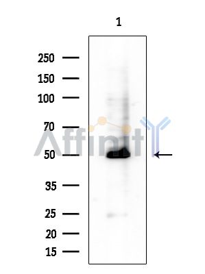 Cytochrome P450 2D6 Antibody - Western blot analysis of extracts from EC304 cells(heat-shock treatment), using Cytochrome P450 2D6 Antibody at 1/1000 dilution.