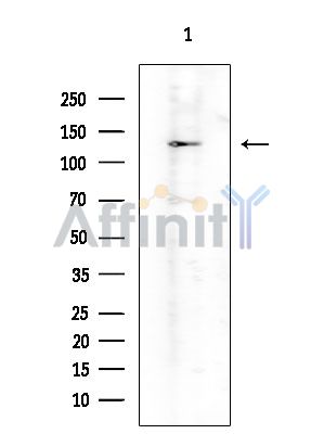 ADAMTS18 Antibody - Western blot analysis of extracts from Mouse testis, using ADAMTS18 Antibody at 1/1000 dilution.