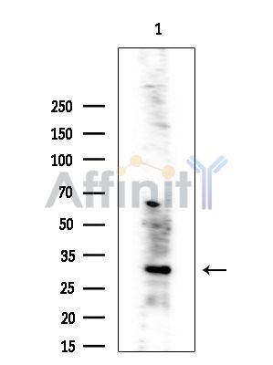 CBR3 Antibody - Western blot analysis of extracts from COLO205 cells(heat-shock treatment), using CBR3 Antibody at 1/1000 dilution.