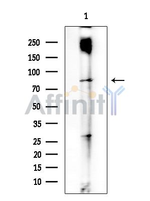 CBCP2 Antibody - Western blot analysis of extracts from EC304 cells(heat-shock treatment), using CBCP2 Antibody at 1/1000 dilution.