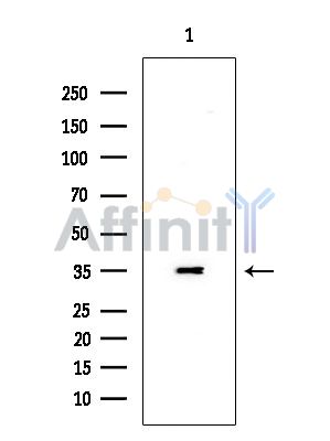 MARCH3 Antibody - Western blot analysis of extracts from EC304 cells(heat-shock treatment), using MARCH3 Antibody at 1/1000 dilution.