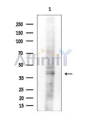NDRG4 Antibody - Western blot analysis of extracts from EC304 cells(heat-shock treatment), using NDRG4 Antibody at 1/1000 dilution.