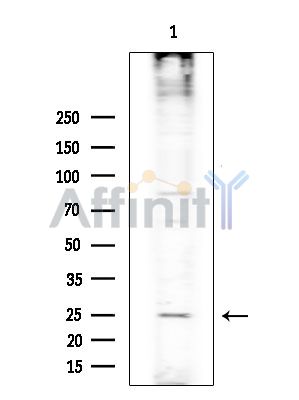 RASL10A Antibody - Western blot analysis of extracts from COLO205 cells(heat-shock treatment), using RASL10A Antibody at 1/1000 dilution.