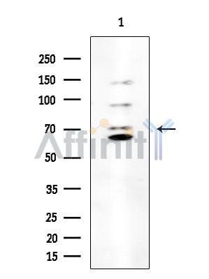 SLC5A2 Antibody - Western blot analysis of extracts from Rat brain, using SLC5A2 Antibody at 1/1000 dilution.